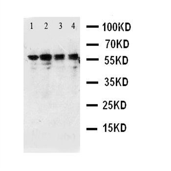 Anti-CaMKK/CAMKK1 Antibody