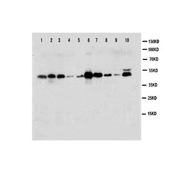Anti-Caspase-1(P10)/CASP1 Antibody