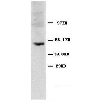 Anti-Caspase-8(P10)/CASP8 Antibody