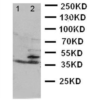 Anti-BCAT1 Antibody