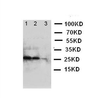 Anti-BAFF/TNFSF13B Antibody