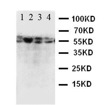 Anti-CD89/FCAR Antibody