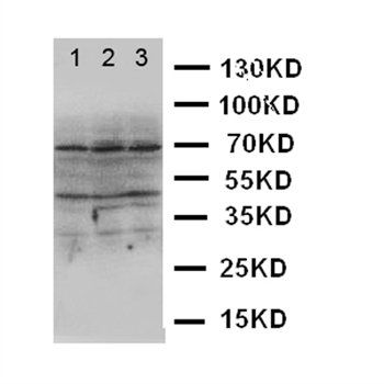 Anti-DAP Kinase 2/DAPK2 Antibody