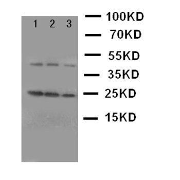Anti-Growth Hormone/GH1 Antibody