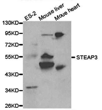 STEAP3 antibody