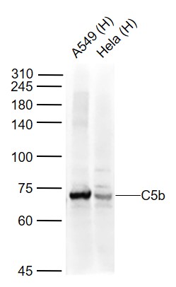 C5b-9 antibody