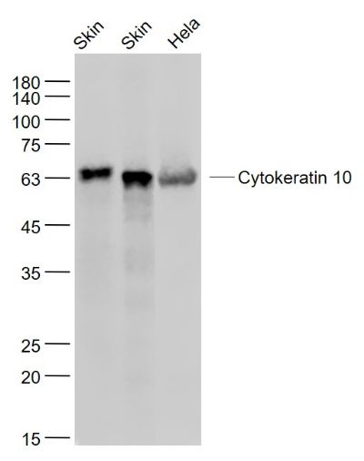 CK10 antibody