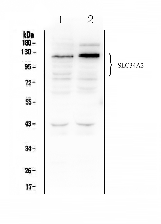 SLC34A2 Antibody