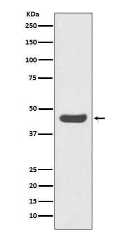 Anti-PD-L1 (CD274) Rabbit Monoclonal Antibody