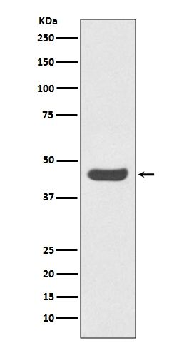 PD-L1 (CD274) Rabbit Monoclonal Antibody