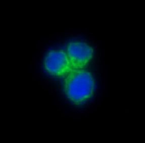 CCR8 Rabbit Monoclonal Antibody