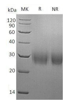 Human Asprosin protein