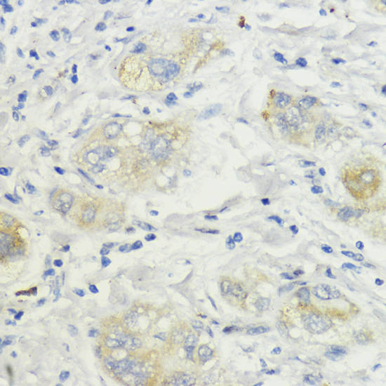 SURF4 Polyclonal Antibody