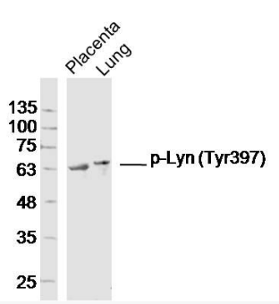 Lyn (phospho-Tyr397) antibody