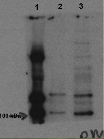 MLK3 (phospho-Thr277/Ser281) antibody