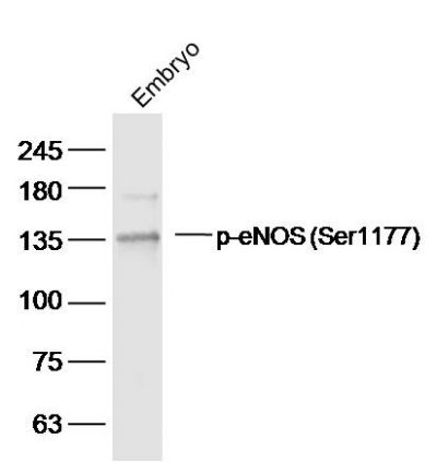 eNOS (phospho-Ser1177) antibody