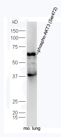AKT3 (phospho-Ser472) antibody