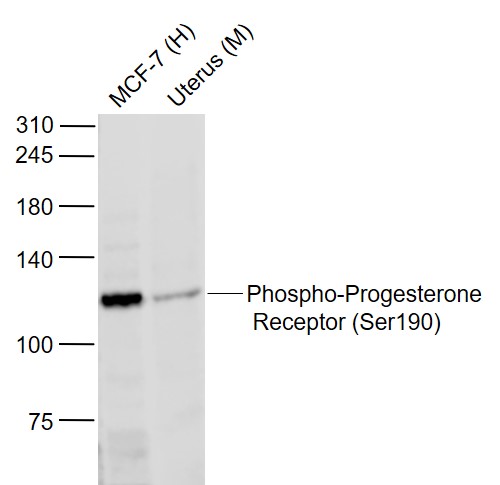 Progesterone Receptor (phospho-Ser190) antibody