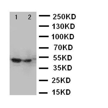 Anti-Forkhead box protein P3 FOXP3 Antibody