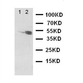 Dopamine Receptor D3/DRD3 Antibody