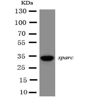Anti-SPARC Antibody