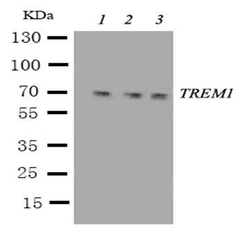 Anti-TREM1 Antibody