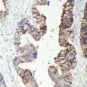 Anti-GST3/GST pi/GSTP1 Antibody