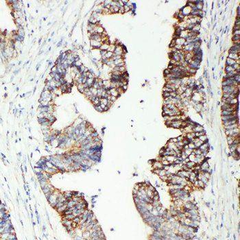 GST3/GST pi/GSTP1 Antibody