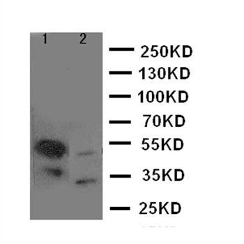 Histone deacetylase 8 HDAC8 Antibody