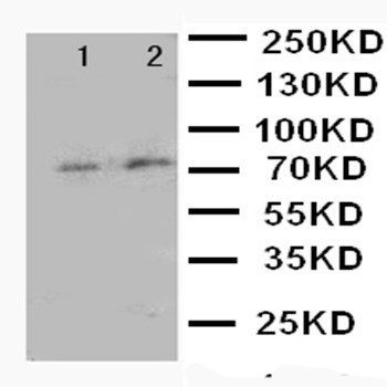 Anti-Forkhead box protein P1 FOXP1 Antibody