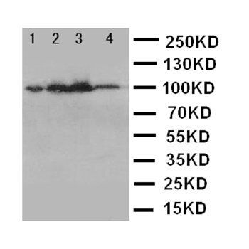 Mineralocorticoid Receptor/NR3C2 Antibody