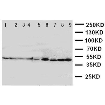 HDJ2/DNAJA1 Antibody