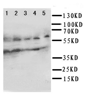 IL2 Receptor gamma/IL2RG Antibody
