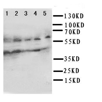 Anti-IL2 Receptor gamma/IL2RG Antibody