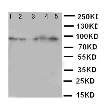CD18/ITGB2 Antibody