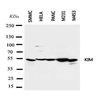 Anti-TIM 1/HAVCR1 Antibody