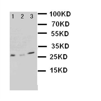Anti-Kallikrein 1/KLK1 Antibody