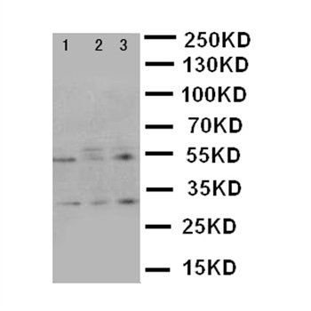 Kallikrein 2/KLK2 Antibody