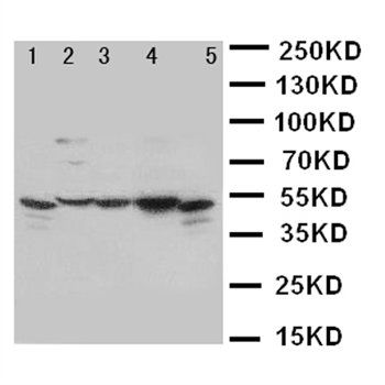 Anti-TIM 1/HAVCR1 Antibody