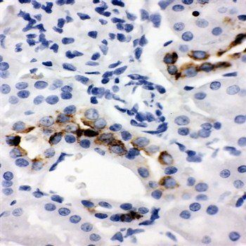 Anti-Kallikrein 1/Ngfg Antibody