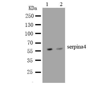 Kallistatin/SERPINA4 Antibody