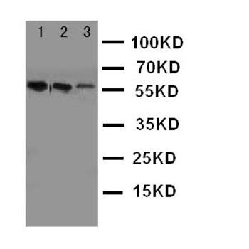 Anti-Angiotensinogen/AGT Antibody