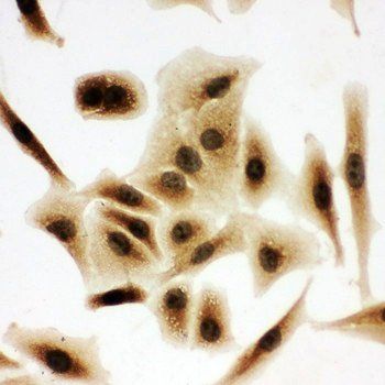 Anti-Bub3 Antibody