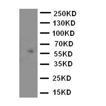 Monoamine Oxidase A/MAOA Antibody