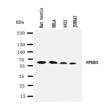 Anti-NF-kB p65/RELA Antibody