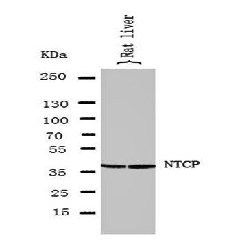 Sodium/bile acid cotransporter SLC10A1 Antibody