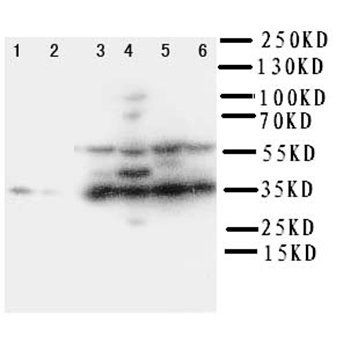 Podoplanin/gp36/PDPN Antibody