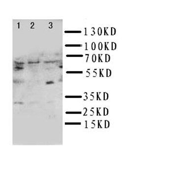 Anti-NUR77/NR4A1 Antibody