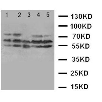 Neurokinin 1 Receptor/TACR1 Antibody