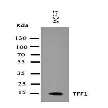 Anti-Estrogen Inducible Protein pS2/TFF1 Antibody